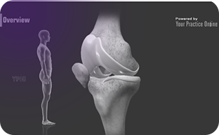 Cartilage Restoration