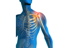 Shoulder Pain